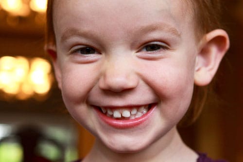 olivia-closeup-smile-may10 olivia-closeup-smile-may10