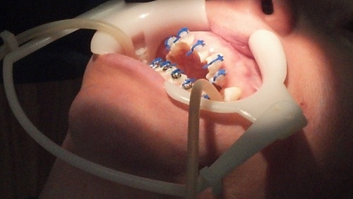 Teeth