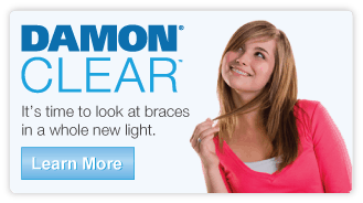 Thumbnail image for Damon Braces Are Making a Difference – My Two Month Update