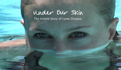 Under Our Skin