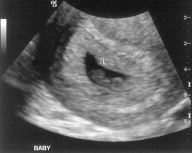 ww-ultrasound-feb19-07-crop1.jpg