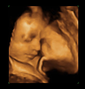 3d-baby-jansbaby-profile.jpg