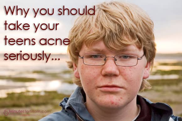 Why You Should Take Your Teen’s Acne Seriously