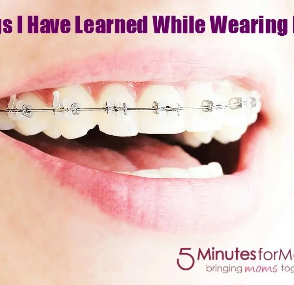 3 Things I Have Learned While Wearing Braces