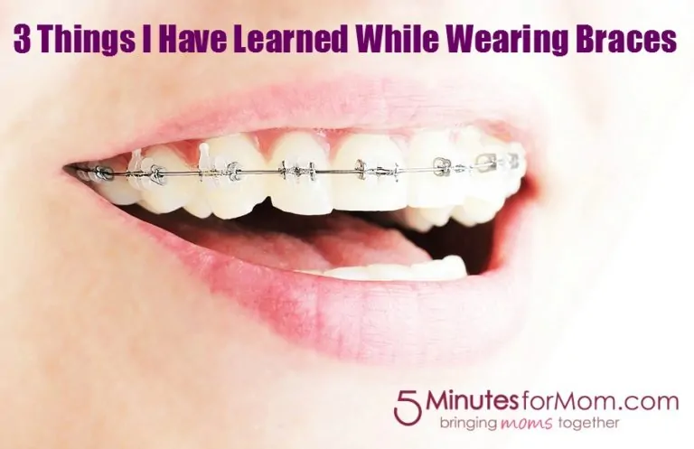 3 Things I Have Learned While Wearing Braces