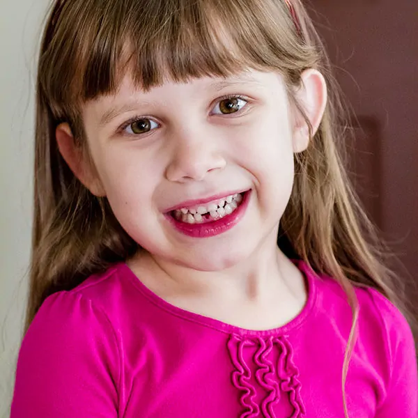 Wordless Wednesday — Sophia Loses Her First Tooth!