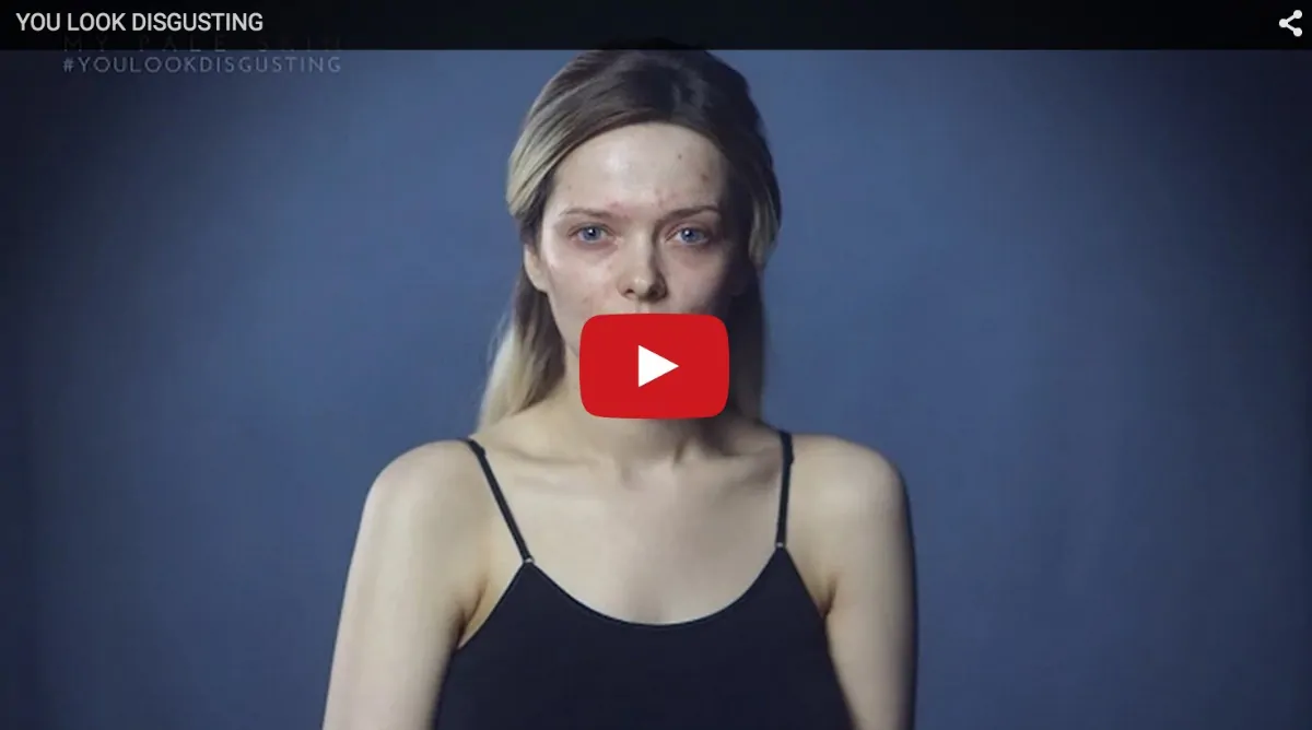 You Look Disgusting - Shocking Video by Beauty Blogger Who Battles Acne