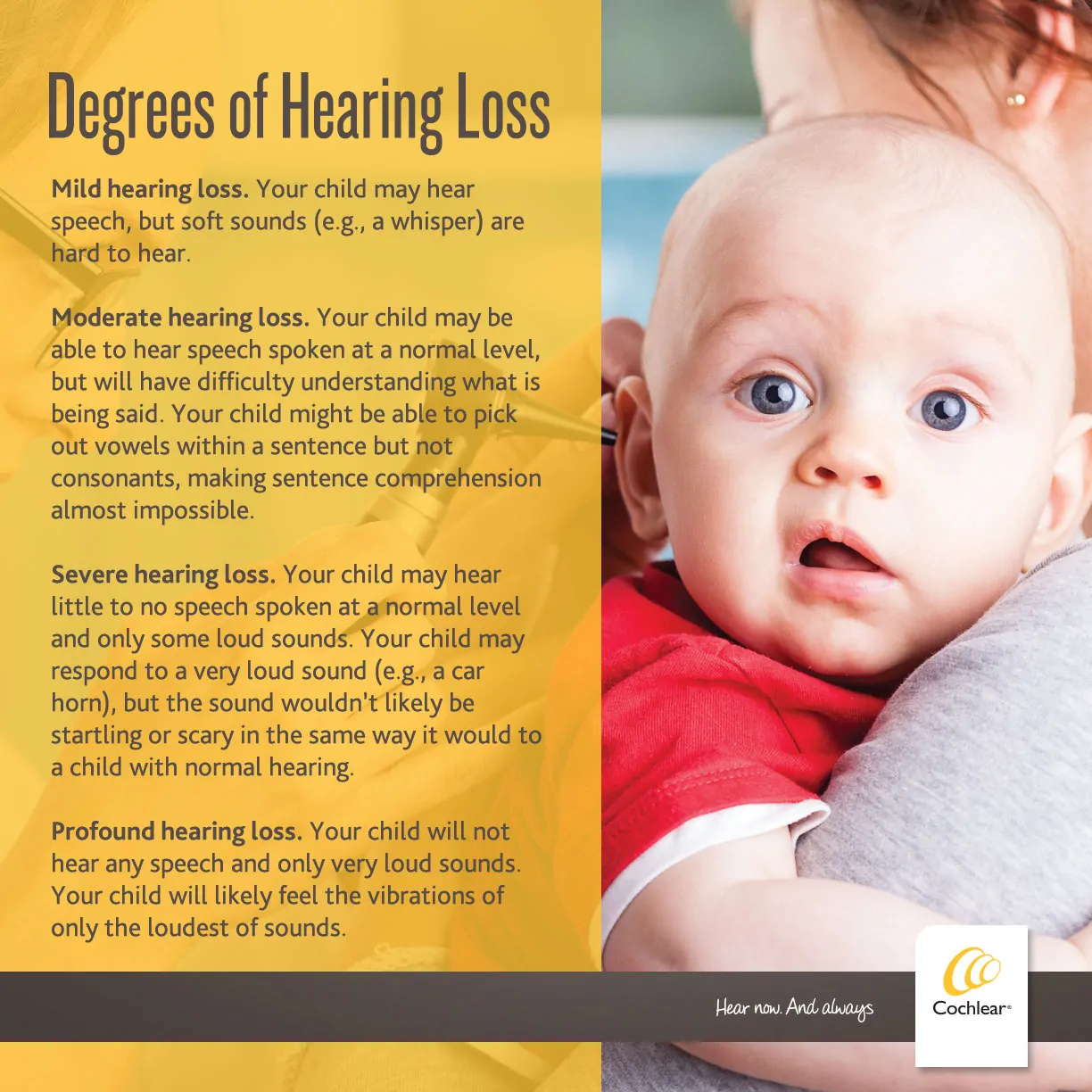 Degrees of Hearing Loss